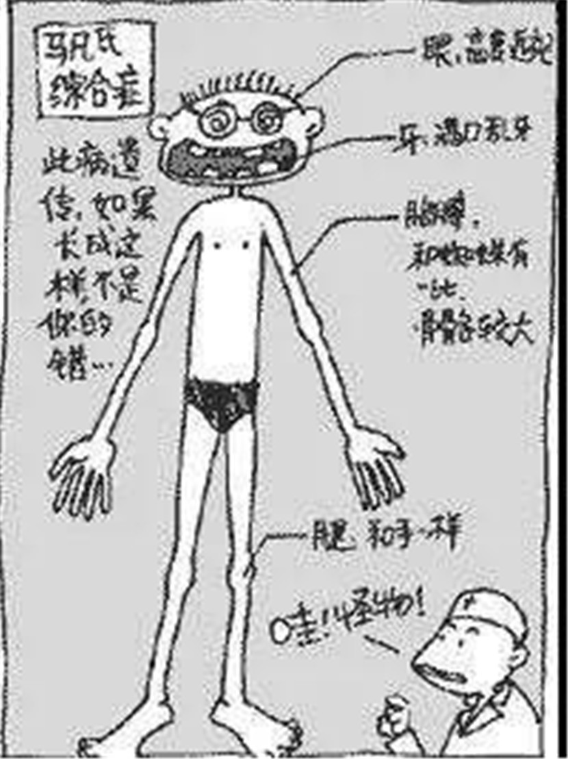 明慈医院 你听说过 马凡综合征 吗 无锡19岁大学生因它险丢命